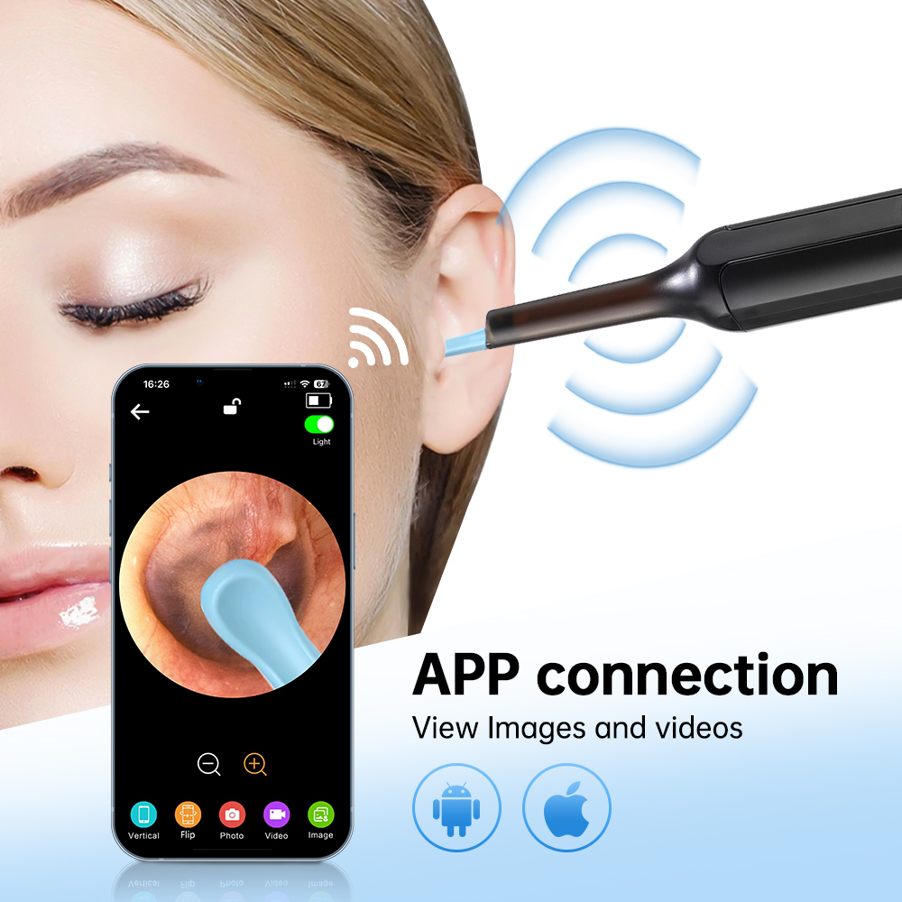 Smart Visual Ear Cleaner Ear S - огляд і ціна Waxing Kit Home